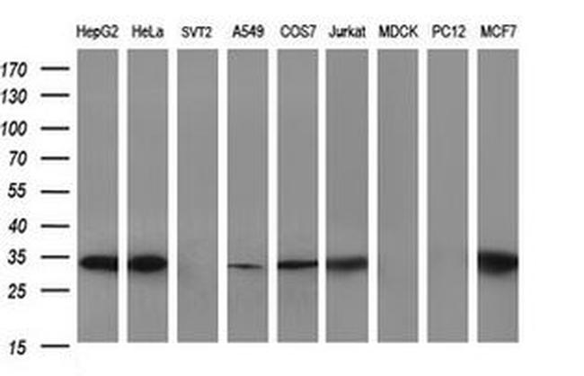 SCAMP2 Antibody in Western Blot (WB)