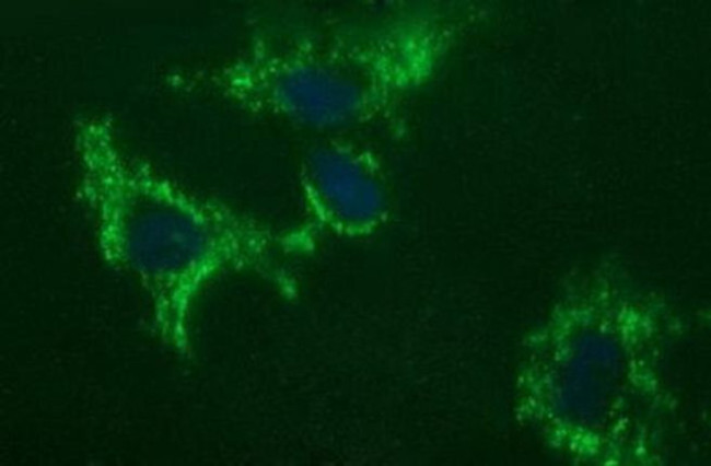 C17orf62 Antibody in Immunocytochemistry (ICC/IF)