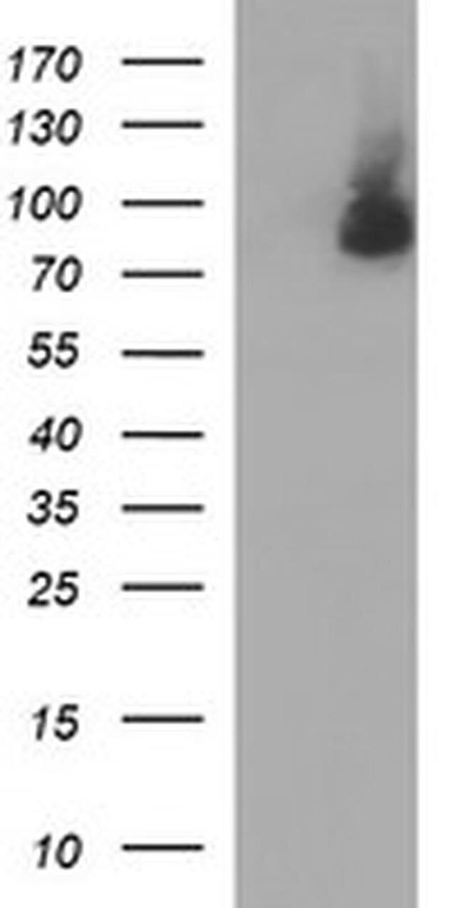 JPH2 Antibody in Western Blot (WB)