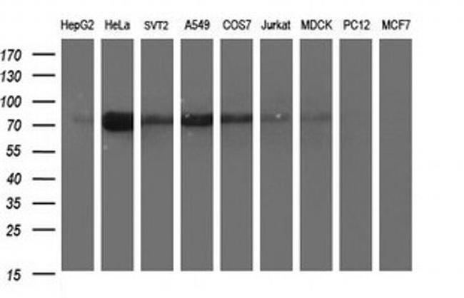 JPH2 Antibody in Western Blot (WB)