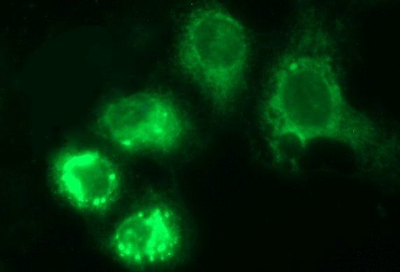 HERPUD1 Antibody in Immunocytochemistry (ICC/IF)