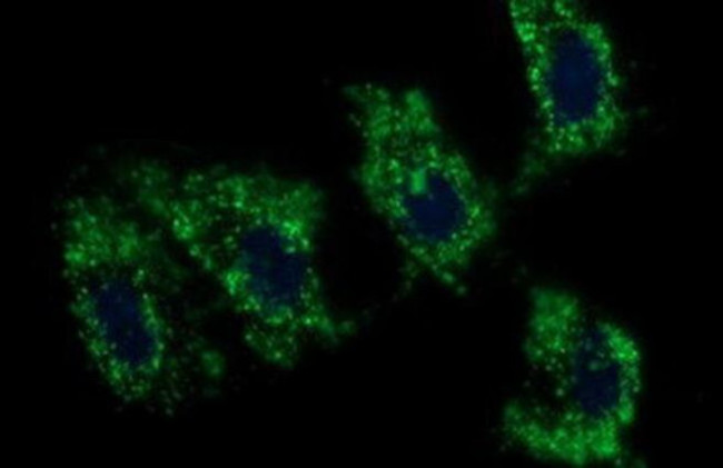 C17orf62 Antibody in Immunocytochemistry (ICC/IF)