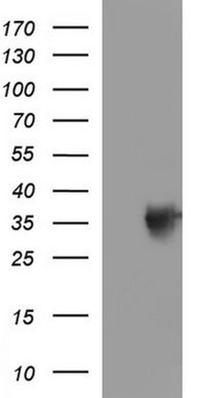 TOLLIP Antibody in Western Blot (WB)