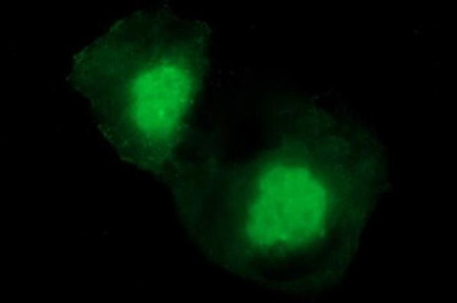 CHAC1 Antibody in Immunocytochemistry (ICC/IF)