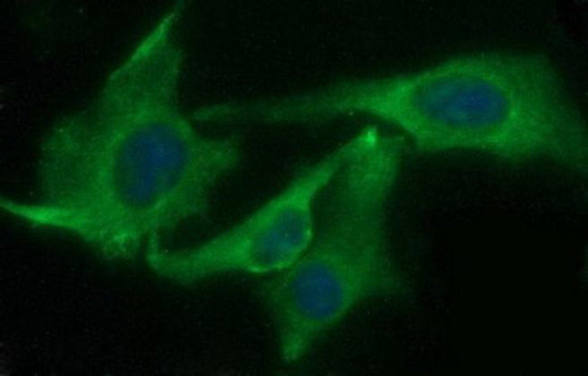 CHAC1 Antibody in Immunocytochemistry (ICC/IF)