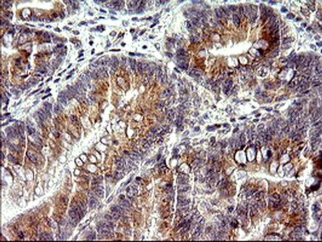 CHAC1 Antibody in Immunohistochemistry (Paraffin) (IHC (P))