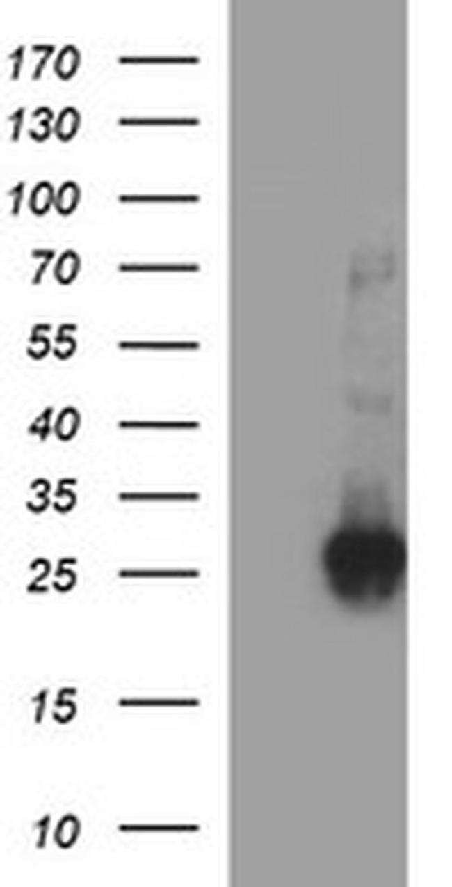 CHAC1 Antibody in Western Blot (WB)