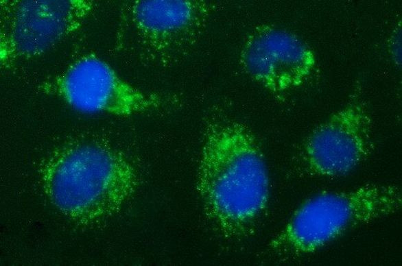 HSD17B4 Antibody in Immunocytochemistry (ICC/IF)