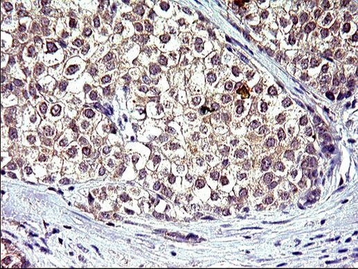 HSD17B4 Antibody in Immunohistochemistry (Paraffin) (IHC (P))