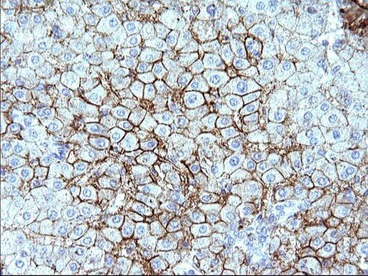 SR-BI Antibody in Immunohistochemistry (Paraffin) (IHC (P))