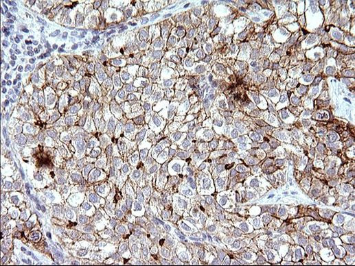 SR-BI Antibody in Immunohistochemistry (Paraffin) (IHC (P))