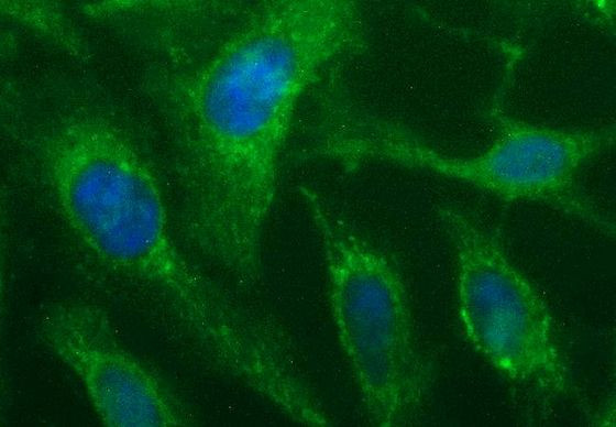 SHBG Antibody in Immunocytochemistry (ICC/IF)