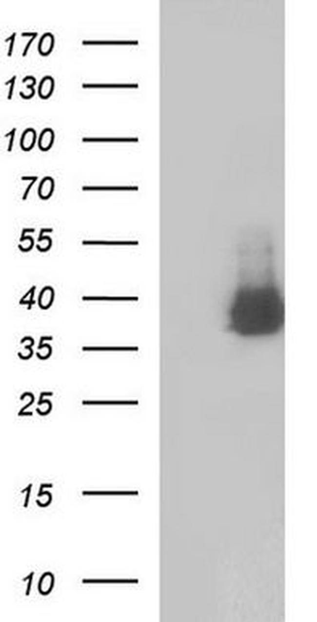 SHBG Antibody in Western Blot (WB)