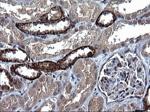 SCF Antibody in Immunohistochemistry (Paraffin) (IHC (P))