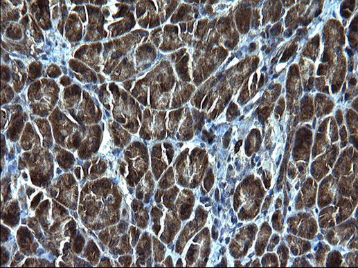 SCF Antibody in Immunohistochemistry (Paraffin) (IHC (P))