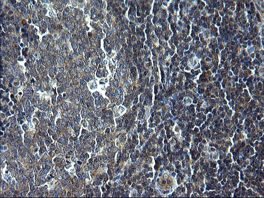 SCF Antibody in Immunohistochemistry (Paraffin) (IHC (P))