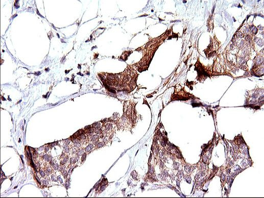 SPHK1 Antibody in Immunohistochemistry (Paraffin) (IHC (P))