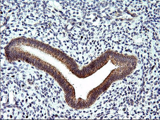 SPHK1 Antibody in Immunohistochemistry (Paraffin) (IHC (P))