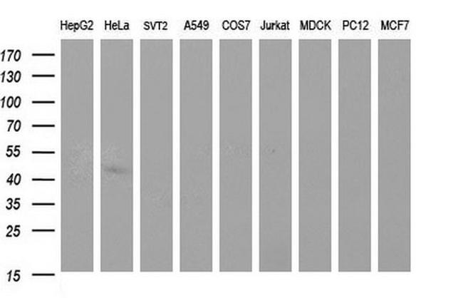 SPHK1 Antibody in Western Blot (WB)