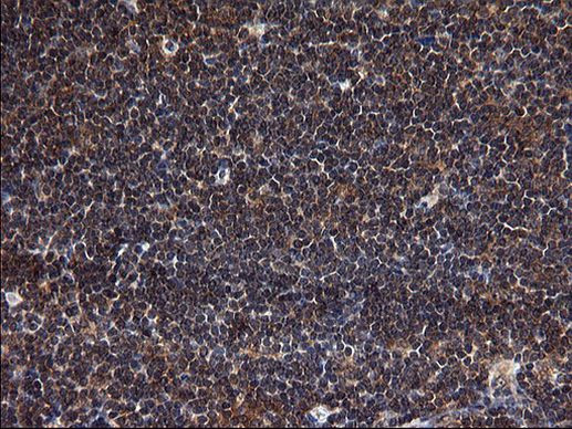 SCRN1 Antibody in Immunohistochemistry (Paraffin) (IHC (P))