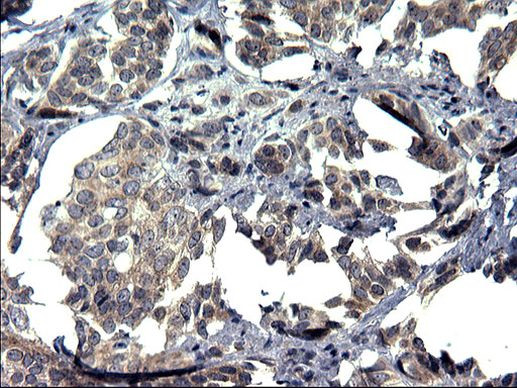 TXNDC5 Antibody in Immunohistochemistry (Paraffin) (IHC (P))