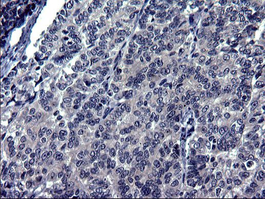 TXNDC5 Antibody in Immunohistochemistry (Paraffin) (IHC (P))