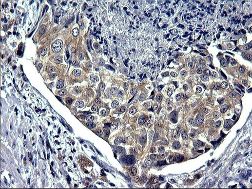 TXNDC5 Antibody in Immunohistochemistry (Paraffin) (IHC (P))