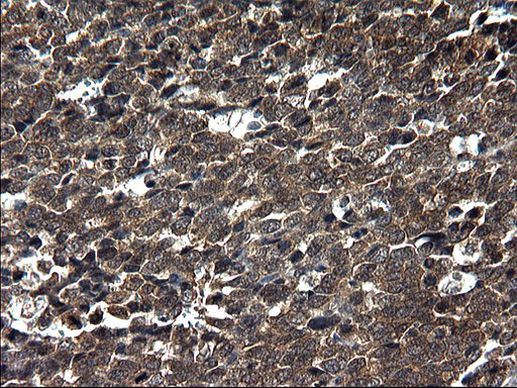 SCRN1 Antibody in Immunohistochemistry (Paraffin) (IHC (P))