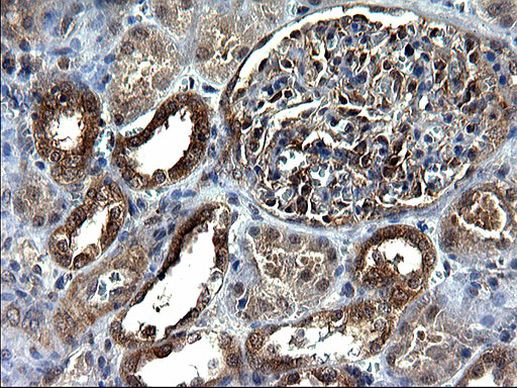 SCRN1 Antibody in Immunohistochemistry (Paraffin) (IHC (P))