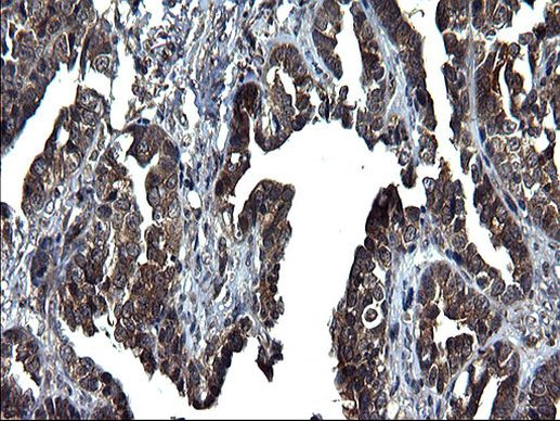 SCRN1 Antibody in Immunohistochemistry (Paraffin) (IHC (P))