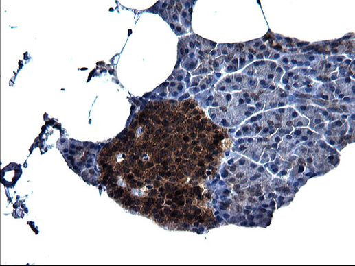 SCRN1 Antibody in Immunohistochemistry (Paraffin) (IHC (P))