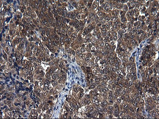 SCRN1 Antibody in Immunohistochemistry (Paraffin) (IHC (P))