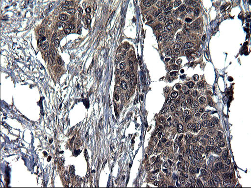 SCRN1 Antibody in Immunohistochemistry (Paraffin) (IHC (P))