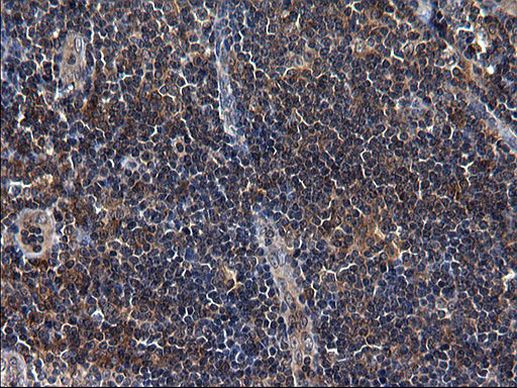 SCRN1 Antibody in Immunohistochemistry (Paraffin) (IHC (P))