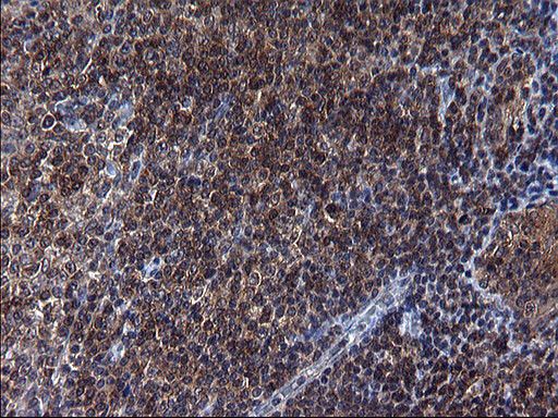 SCRN1 Antibody in Immunohistochemistry (Paraffin) (IHC (P))