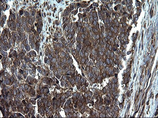 Alix Antibody in Immunohistochemistry (Paraffin) (IHC (P))