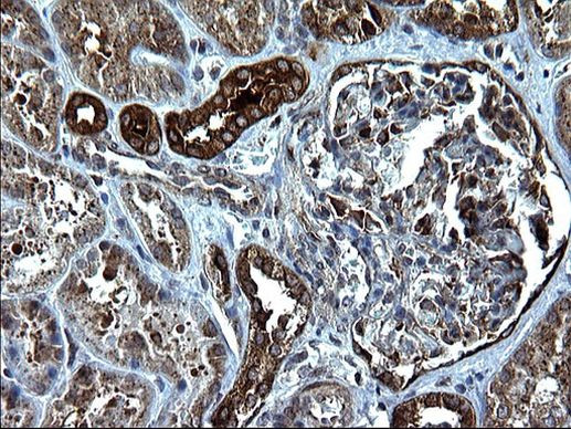 Alix Antibody in Immunohistochemistry (Paraffin) (IHC (P))