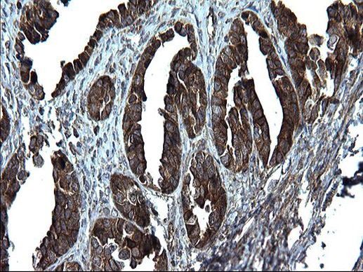 Alix Antibody in Immunohistochemistry (Paraffin) (IHC (P))