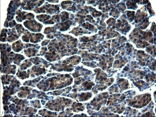 GCLC Antibody in Immunohistochemistry (Paraffin) (IHC (P))