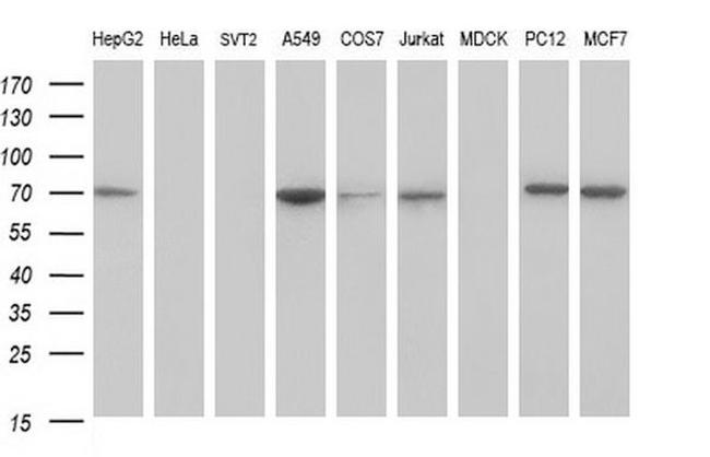 GCLC Antibody in Western Blot (WB)