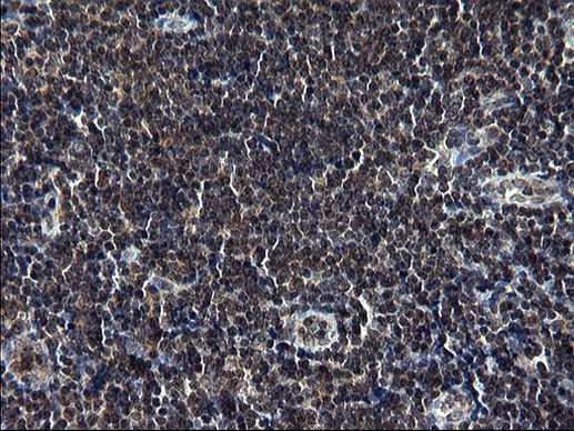 TBX1 Antibody in Immunohistochemistry (Paraffin) (IHC (P))