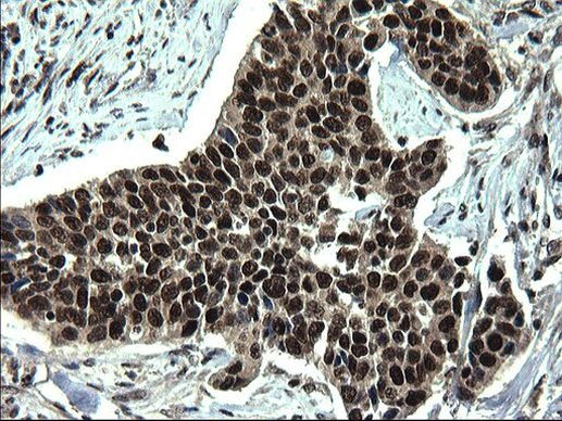 RPRD1B Antibody in Immunohistochemistry (Paraffin) (IHC (P))