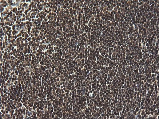 RPRD1B Antibody in Immunohistochemistry (Paraffin) (IHC (P))