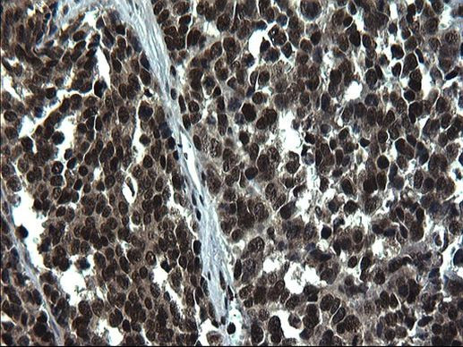 RPRD1B Antibody in Immunohistochemistry (Paraffin) (IHC (P))