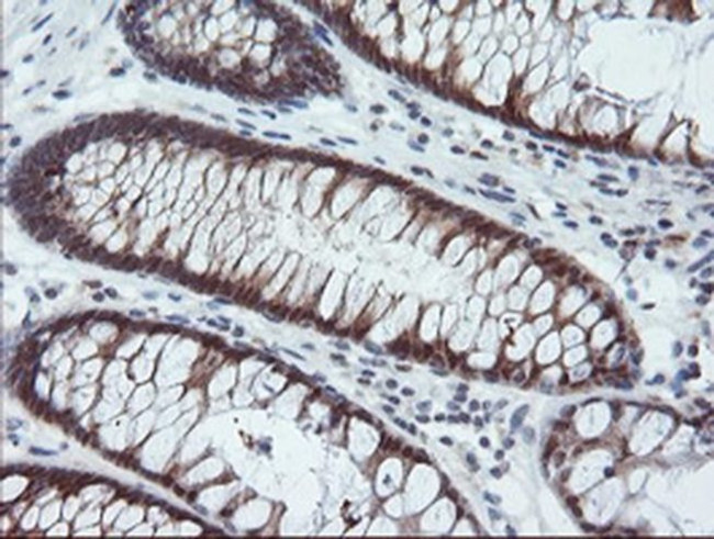 PYCARD Antibody in Immunohistochemistry (Paraffin) (IHC (P))