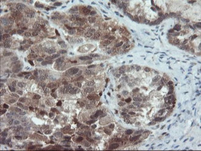 PYCARD Antibody in Immunohistochemistry (Paraffin) (IHC (P))