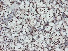 UBE2E3 Antibody in Immunohistochemistry (Paraffin) (IHC (P))