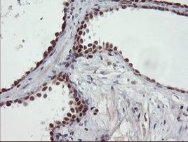 UBE2E3 Antibody in Immunohistochemistry (Paraffin) (IHC (P))