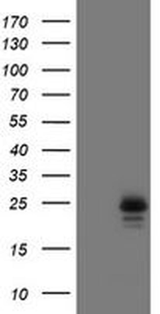 UBE2E3 Antibody in Western Blot (WB)