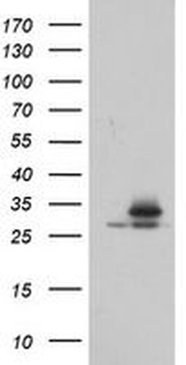 PSMA6 Antibody in Western Blot (WB)